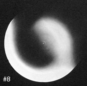 a knife edge at 45 degrees shows the astigmatism