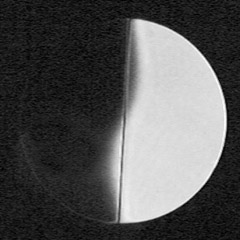 astigmatic sphere with knife edge
