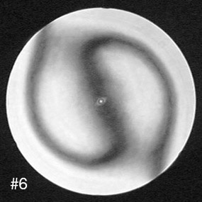 the wire test at 45 degrees shows the astigmatism